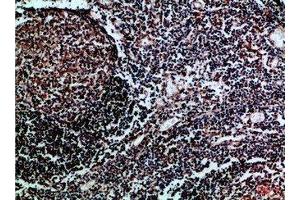 Immunohistochemical analysis of paraffin-embedded Human-tonsil, antibody was diluted at 1:100