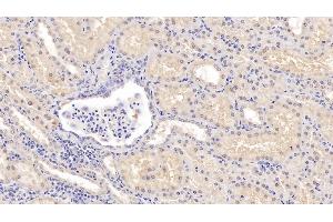 Detection of COMT in Human Kidney Tissue using Polyclonal Antibody to Catechol-O-Methyltransferase (COMT) (COMT 抗体  (AA 52-271))