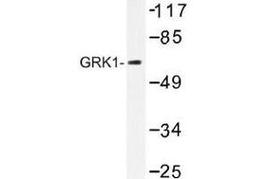 Image no. 1 for anti-G Protein-Coupled Receptor Kinase 1 (GRK1) antibody (ABIN317886) (GRK1 抗体)