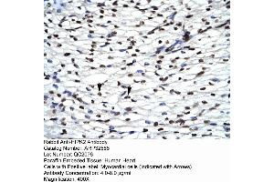 Rabbit Anti-HIPK2 Antibody  Paraffin Embedded Tissue: Human Heart Cellular Data: Myocardial cells Antibody Concentration: 4. (HIPK2 抗体  (Middle Region))