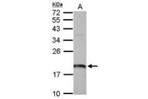 Image no. 1 for anti-ADP Ribosylation Factor Like GTPase 1 (ARL1) (AA 1-163) antibody (ABIN1496712) (ARL1 抗体  (AA 1-163))