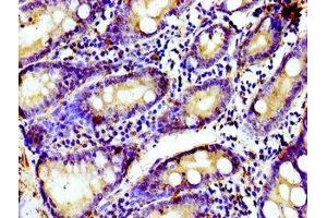 Immunohistochemistry of paraffin-embedded human small intestine tissue using ABIN7153569 at dilution of 1:100 (TUBGCP4 抗体  (AA 203-309))