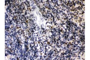 Immunohistochemistry (IHC) image for anti-Class II, Major Histocompatibility Complex, Transactivator (CIITA) (AA 945-1130) antibody (ABIN4886541)