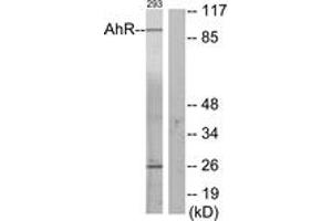 Western blot analysis of extracts from 293 cells, using AhR (Ab-36) Antibody. (Aryl Hydrocarbon Receptor 抗体  (AA 2-51))