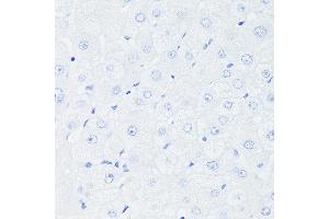 Immunohistochemistry of paraffin-embedded Human liver (negative control sample) using [KO Validated] p53 Rabbit mAb (ABIN7271080) at dilution of 1:100 (40x lens). (p53 抗体)