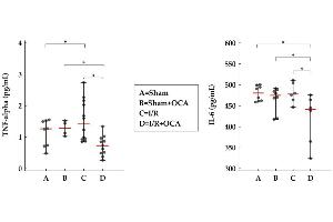 OCA treatment decreases cortex TNF-alpha and IL-6 in rats submitted to partial liver ischemia (60 min) followed by reperfusion (120 min).