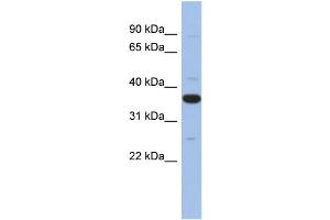 WB Suggested Anti-MYD88 Antibody Titration: 0. (MYD88 抗体  (Middle Region))