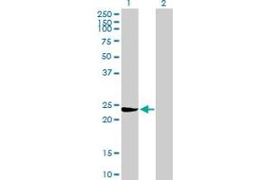 Western Blot analysis of GSTM3 expression in transfected 293T cell line by GSTM3 MaxPab polyclonal antibody. (GSTM3 抗体  (AA 1-225))