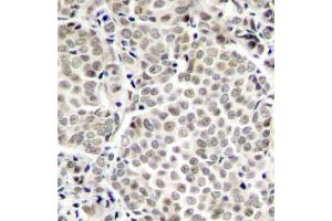 Immunohistochemistry (IHC) image for anti-Nuclear Factor-kB p65 (NFkBP65) (pSer529) antibody (ABIN1870581) (NF-kB p65 抗体  (pSer529))