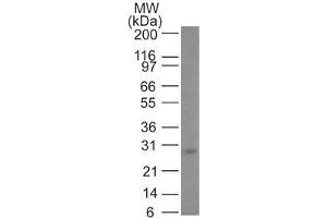 Western Blotting (WB) image for anti-B-Cell CLL/lymphoma 2 (BCL2) (AA 41-54) antibody (ABIN6940492)