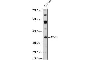 Western blot analysis of extracts of Rat liver, using SCML1 antibody (ABIN7270268) at 1:1000 dilution. (SCML1 抗体  (AA 50-200))