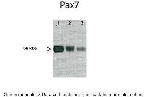 Western Blotting (WB) image for anti-Paired Box 7 (PAX7) (N-Term) antibody (ABIN2779615)