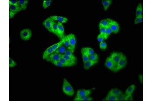 Immunofluorescence staining of HepG2 cells with ABIN7168797 at 1:100, counter-stained with DAPI.