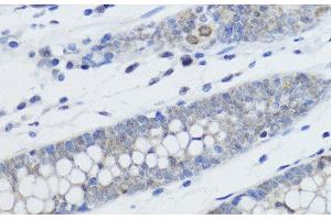 Immunohistochemistry of paraffin-embedded Human colon using MonoMethyl-Histone H4-K20 Polyclonal Antibody at dilution of 1:200 (40x lens). (Histone H4 抗体  (meLys20))