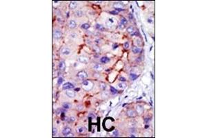 Immunohistochemistry (Paraffin-embedded Sections) (IHC (p)) image for anti-Calcium/calmodulin-Dependent Protein Kinase ID (CAMK1D) (AA 302-333), (C-Term) antibody (ABIN391307)