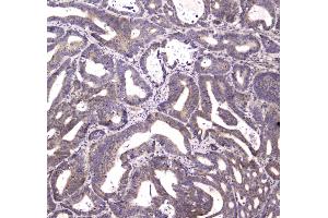IHC analysis of HTRA1 using anti-HTRA1 antibody . (HTRA1 抗体)