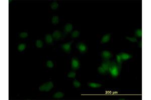 Immunofluorescence of monoclonal antibody to DPH1 on HeLa cell. (DPH1 抗体  (AA 216-324))