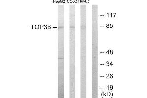 Western Blotting (WB) image for anti-Topoisomerase (DNA) III beta (TOP3B) (N-Term) antibody (ABIN1849086) (TOP3B 抗体  (N-Term))