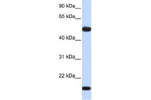 Human Muscle; WB Suggested Anti-ADSSL1 Antibody Titration: 0.