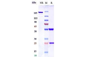 Anti-RTN4 / NOGO Reference Antibody (NG-101) on SDS-PAGE under reducing (R) condition.