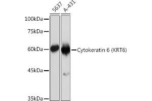 Western blot analysis of extracts of various cell lines, using Cytokeratin 6 (KRT6) (KRT6) Rabbit mAb (ABIN7268104) at 1:1000 dilution. (Keratin 6C 抗体)