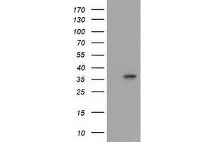 HEK293T cells were transfected with the pCMV6-ENTRY control (Left lane) or pCMV6-ENTRY ANXA3 (Right lane) cDNA for 48 hrs and lysed. (Annexin A3 抗体)