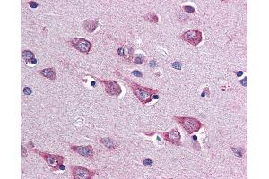 Anti-SOCS1 antibody IHC of human brain, cortex.