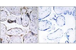 Immunohistochemistry analysis of paraffin-embedded human placenta, using ELOVL3 Antibody. (ELOVL3 抗体  (AA 31-80))