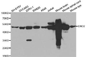 Western blot analysis of extracts of various cell lines, using ENO2 antibody (ABIN5971596) at 1/500 dilution. (ENO2/NSE 抗体)