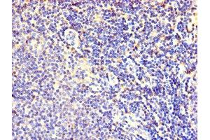 Immunohistochemistry of paraffin-embedded human lymphoid tissue using ABIN7152464 at dilution of 1:100