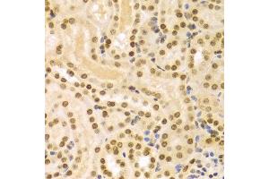 Immunohistochemistry of paraffin-embedded Mouse kidney using DKC1 antibody at dilution of 1:100 (x400 lens). (DKC1 抗体  (AA 245-514))