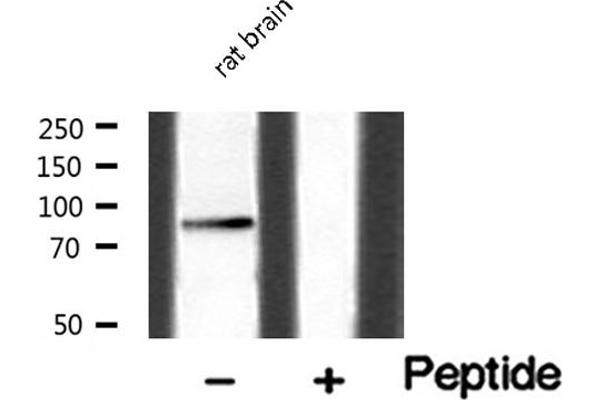 HGS 抗体  (Internal Region)