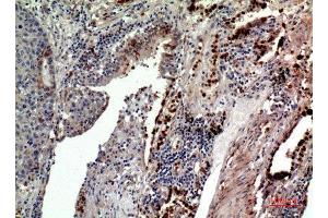 Immunohistochemistry (IHC) analysis of paraffin-embedded Human Lung, antibody was diluted at 1:100. (CD163L1 抗体  (Internal Region))