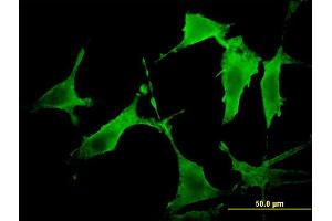 Immunofluorescence of monoclonal antibody to PAK3 on NIH/3T3 cell. (PAK3 抗体  (AA 1-90))