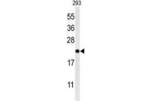 Western blot analysis of MRAP (arrow) in 293 cell line lysates (35ug/lane) using MRAP Antibody (N-term). (MRAP 抗体  (N-Term))