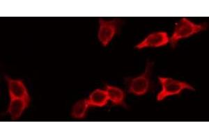 ABIN6266713 staining HeLa by IF/ICC. (Ephrin A2 抗体  (N-Term))