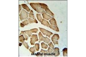 LDHD Antibody (N-term) (ABIN651920 and ABIN2840455) immunohistochemistry analysis in formalin fixed and paraffin embedded human skeletal muscle followed by peroxidase conjugation of the secondary antibody and DAB staining. (LDHD 抗体  (N-Term))