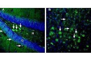 Expression of GPR83 in mouse hippocampus and cortex - Immunohistochemical staining of perfusion-fixed frozen mouse brain sections with Anti-GPR83 (extracellular) Antibody (ABIN7043174, ABIN7044445 and ABIN7044446), (1:3000), followed by goat anti-rabbit-AlexaFluor-488. (GPR83 抗体  (Extracellular))