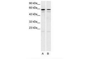 Image no. 1 for anti-5-Hydroxytryptamine (serotonin) Receptor 2C (HTR2C) (AA 28-77) antibody (ABIN202566)