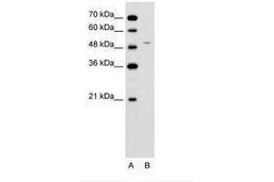 Image no. 2 for anti-Ferrochelatase (FECH) (AA 51-100) antibody (ABIN6736623) (FECH 抗体  (AA 51-100))