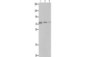 Western Blotting (WB) image for anti-Melanoma Antigen Family D, 1 (MAGED1) antibody (ABIN2421821)