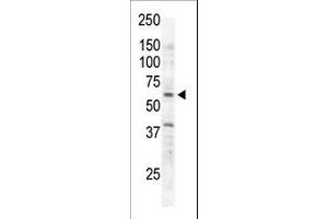 Western Blotting (WB) image for anti-RYK Receptor-Like Tyrosine Kinase (RYK) (AA 160-190) antibody (ABIN392050)