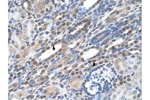 Immunohistochemistry (IHC) image for anti-Nucleolar and Coiled-Body Phosphoprotein 1 (NOLC1) (C-Term) antibody (ABIN630195)