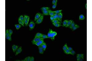 Immunofluorescence (IF) image for anti-Carbamoyl-Phosphate Synthase 1, Mitochondrial (CPS1) (AA 1361-1500) antibody (ABIN7146668)