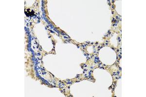 Immunohistochemistry of paraffin-embedded rat lung using IL36G antibody (ABIN5974550) at dilution of 1/100 (40x lens). (IL1F9 抗体)