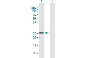 Western Blot analysis of MMP7 expression in transfected 293T cell line by MMP7 MaxPab polyclonal antibody. (MMP7 抗体  (AA 1-267))