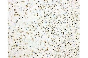 IHC-F testing of mouse brain tissue (HDAC3 抗体  (AA 411-428))