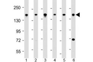 Western blot testing of human 1) 293T/17, 2) DU-145, 3) LNCaP, 4) Raji, 5) U-2OS and 6) HeLa cell lysate with PDS5B antibody at 1:2000. (PDS5B 抗体  (AA 1197-1228))