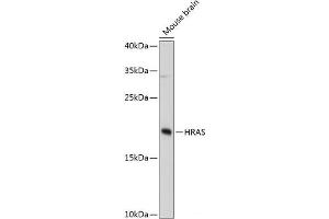 Western blot analysis of extracts of Mouse brain using HRAS Polyclonal Antibody at dilution of 1:3000. (HRAS 抗体)