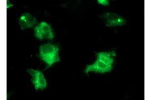Immunofluorescence (IF) image for anti-Interferon Regulatory Factor 6 (IRF6) antibody (ABIN1498903) (IRF6 抗体)